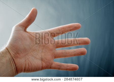 Adult Hand With Raynaud's Syndrome - Phenomenon. Close Up Hand With Fingers On Dark Background With 