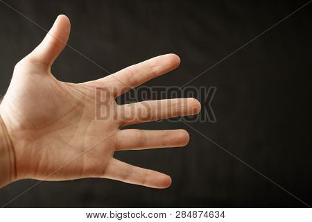 Adult Hand With Raynaud's Syndrome - Phenomenon. Close Up Hand With Fingers On Dark Background With 