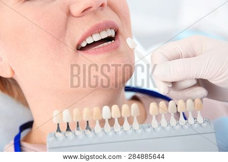 Dentist Selecting Patient's Teeth Color With Palette In Clinic, Closeup