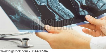 Female Doctors Hand Pointing At X-ray Or Mri Medical Imaging With A Head And Neck Condition. Spinal 