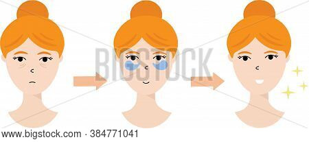 Vector Illustration Of The Women With Eye Patches, Isolated On White Background. Instruction For App