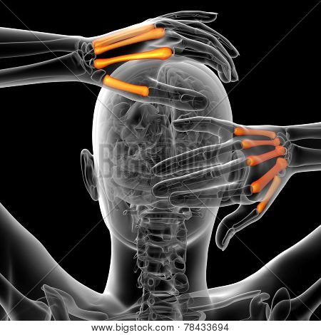 3D Render Medical Illustration Of The Metacarpal Bone