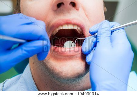 Close-up of male patient with open mouth during oral checkup at the dentist. Healthcare Dentist concept. Selective focus.