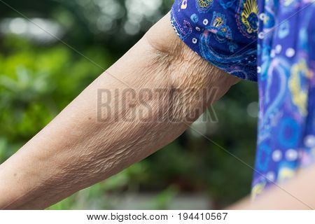elderly arm skin with deep wrinkles .