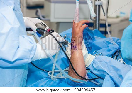 Group Of Orthopedic Surgeons Performing A Wrist Arthroscopy On A Male Patient