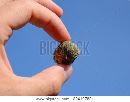 Stone Of The Gallbladder. The Result Of Gallstones. A Calculus Of Heterogeneous Composition Against 