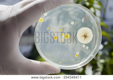 Researcher Hand In Glove Holding Petri Dish With Colonies Of Different Bacteria And Molds On Natural