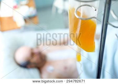 Transfusion Of Fresh Frozen Plazma (ffp), Bag On Stand
