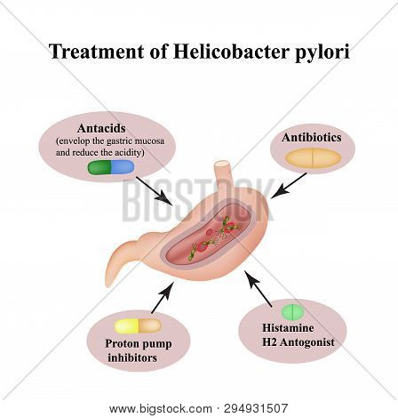 Treatment Of Helicobacter Pylori. Medications. Antacids, Proton Pump Blockers And H2-histamine Block