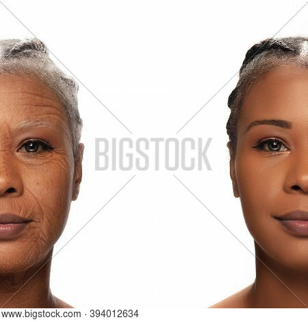 Comparison. Portrait Of Beautiful African Woman With Problem And Clean Skin, Aging And Youth Concept