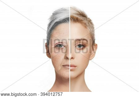 Comparison. Portrait Of Beautiful Woman With Problem And Clean Skin, Aging And Youth Concept, Beauty