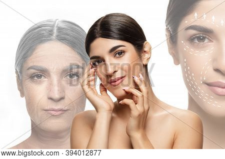 Comparison. Portrait Of Beautiful Jewish Woman With Problem And Clean Skin, Aging And Youth Concept,