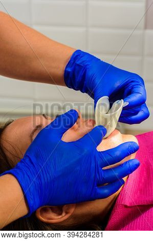 A Young Female Dentist Pulls A Mouth Extender At A Dental Clinic. Mouth Dilator And Retractor.