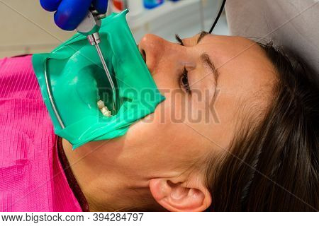 The Dentist Installs A Rubber Dam, Sterile Dental Treatment, Modern Equipment In Dentistry.