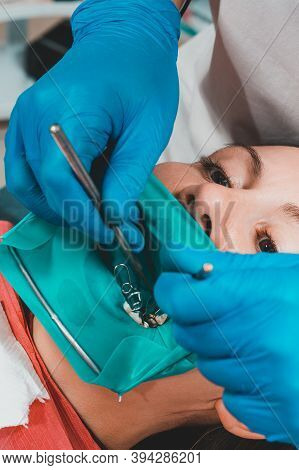 Dental Restoration And Polymerization Of Tooth Composite Materials, The Doctor Conducts Sterile Work