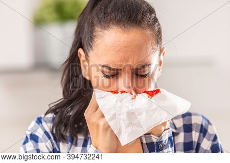 Woman Clears Her Nose, Unaware Of Bleeding That Appeared On A Tissue.