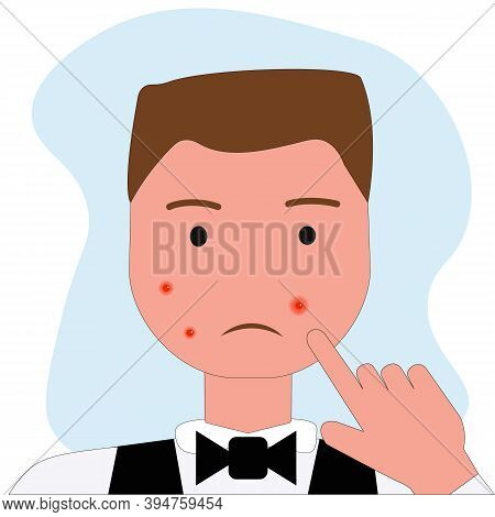 Portrait Of Young Man With Acne Problem Squishing Pimples On Light Background