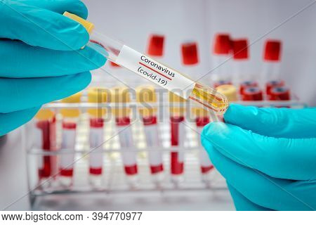 Test Tubes Containing Plasma Extracted From The Blood Of People Who Had Been Ill With Coronavirus, C
