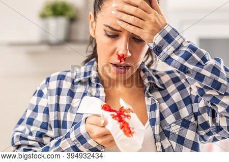 Woman Find Out Her Nose Is Bleeding After Sneezing Into A Tissue.
