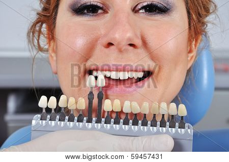 Shade Determination Tooth