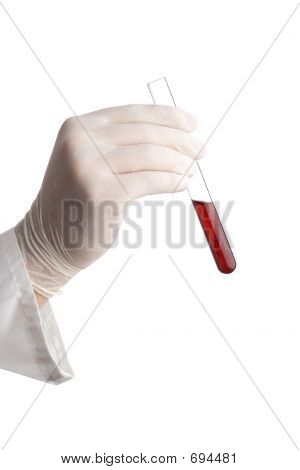 Manejo de trabajador de laboratorio muestras de sangre