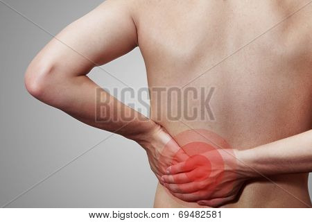 Umbosacral Radiculitis