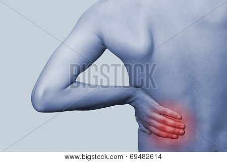 Umbosacral Radiculitis