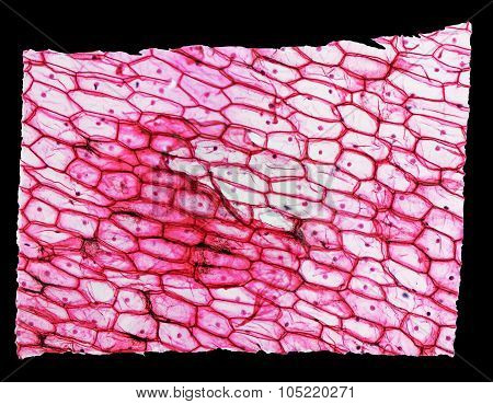 Onion Epidermus Micrograph
