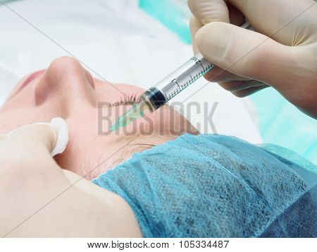 Cosmetology procedure mesoteraphy. Rejuvenation revitalization, skin nutrition, wrinkle reduction. D