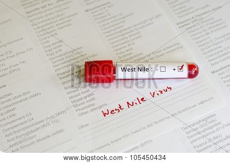 West Nile blood sample