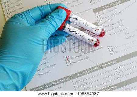 Sexually transmitted diseases
