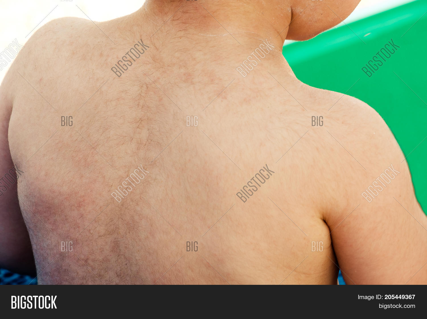 Newborn Hairy Back Image & Photo (Free Trial) Bigstock