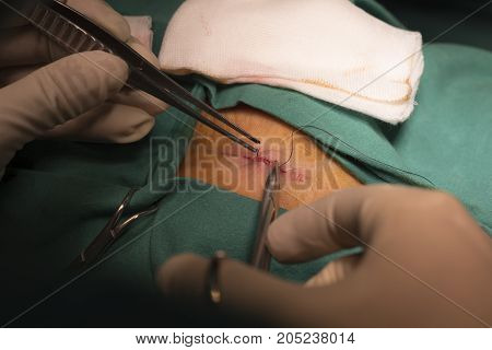 Doctor holding needle holder for suturing the wound in the operating room
