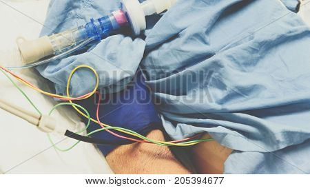 Patient Do Tracheostomy And Ventilator In Hospital