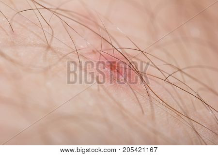 wound on the skin. macro . Photo of an abstract texture