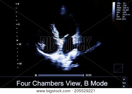 Colourful Image Of Homan Heart Ultrasound Monitor