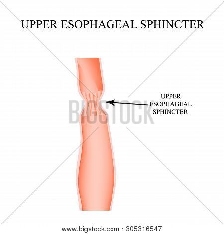 Upper Sphincter Of Esophagus. Infographics. Illustration On Isolated Background.