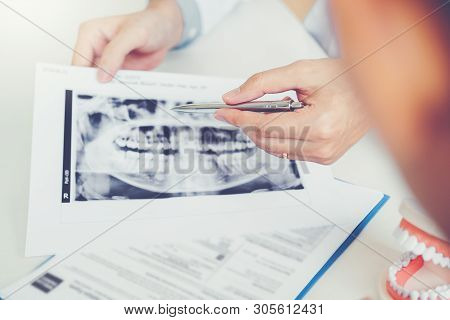 Dentist Talking To Male Patient And Presenting Results On Dental X-ray Film About The Problem Of The