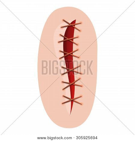 Wound Suture Icon. Cartoon Of Wound Suture Vector Icon For Web Design Isolated On White Background