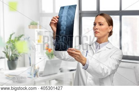 medicine, radiology and healthcare concept - female doctor in white coat with x-ray scan image of spine over medical office at hospital on background