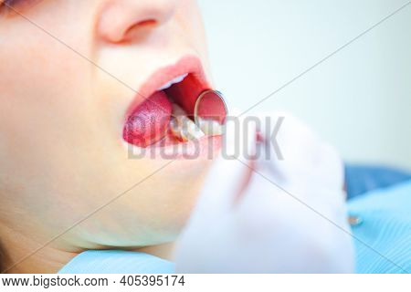 Dentist examining a patient's teeth in the dentist ofiice, Close Up Shot