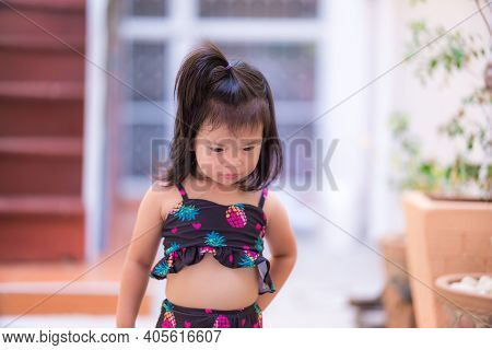 Children Have Itching. Baby Aged 3 - 4 Years.