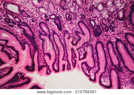 Cell Microscopic- Pyloric Division Stomach