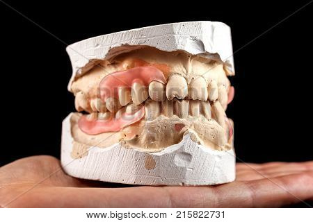A denture on a gypsum base in the hand of a dentist. Close-up on a black background