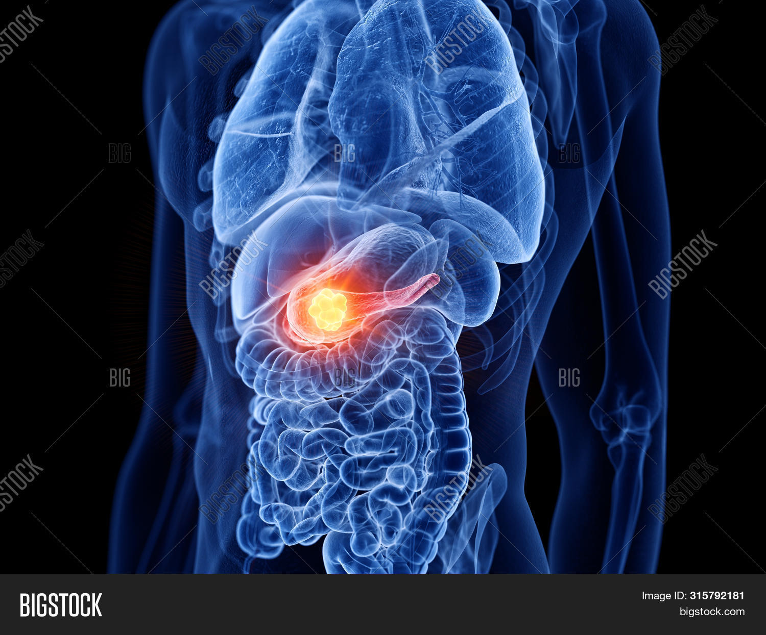 3d Rendered Medically Image & Photo (Free Trial) | Bigstock