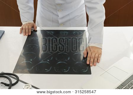 Doctor Check Up X-ray Film Of The Brain By Ct Scan Brain At Patient Room Hospital.