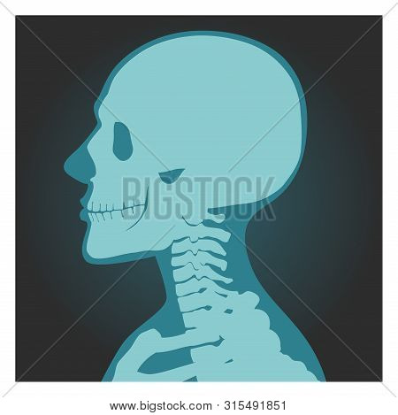 X-ray Shot Of Skull, Human Body, Head And Neck Bones Side View, Radiography, Vector Illustration.