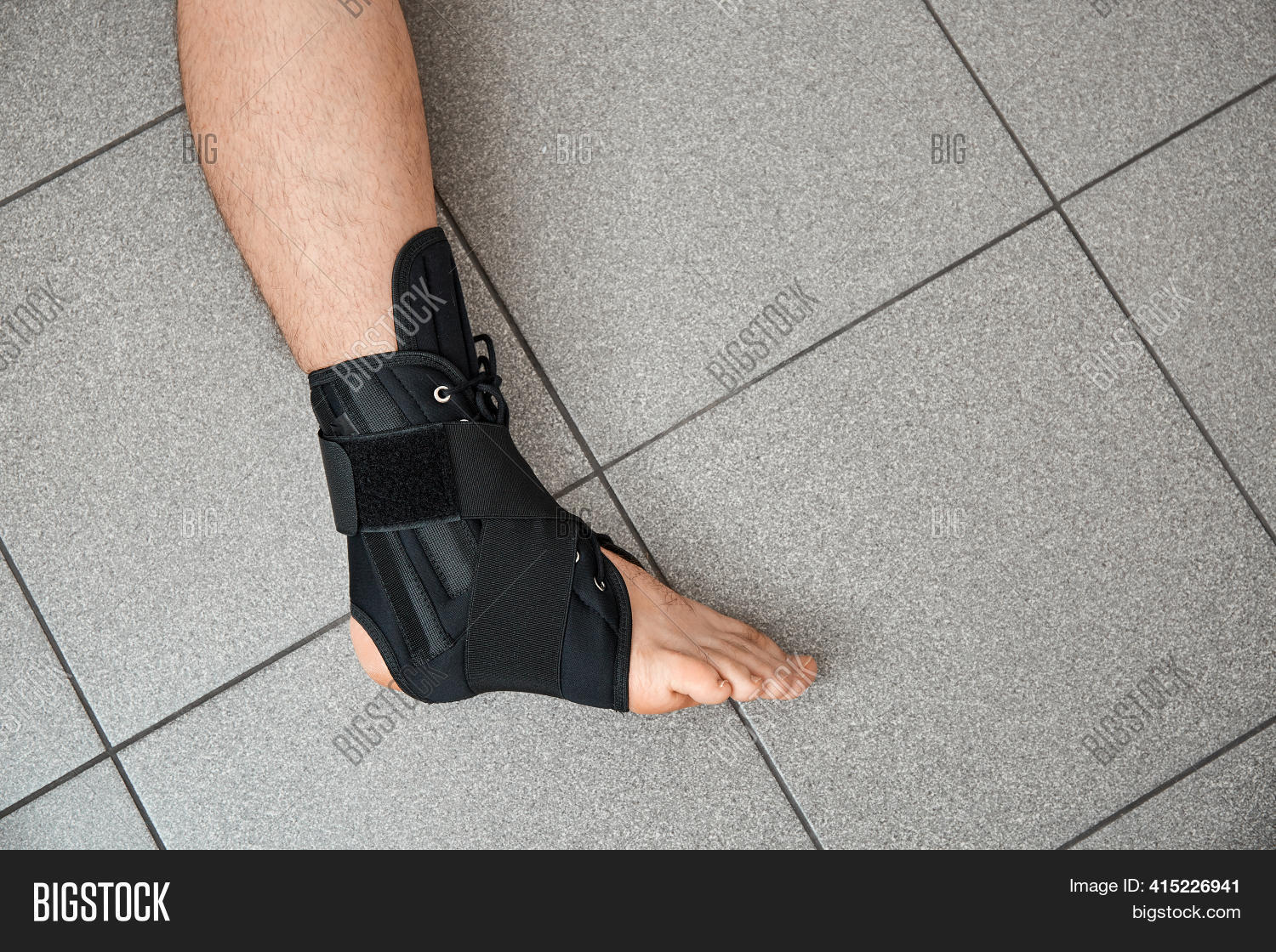 Fixed Leg2 Male Leg Fixed Medical Image & Photo (Free Trial) | Bigstock