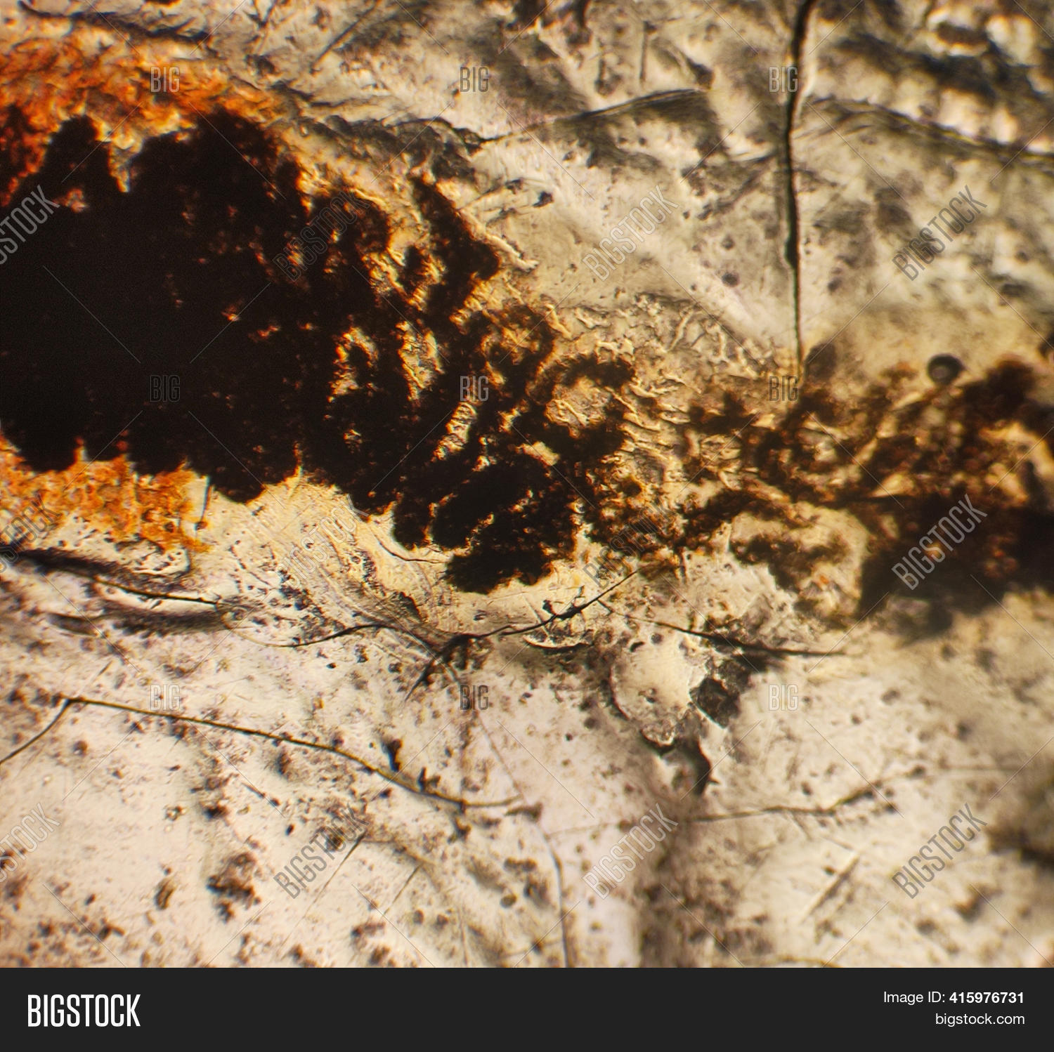 Pinworms Eggs Image & Photo (Free Trial) Bigstock