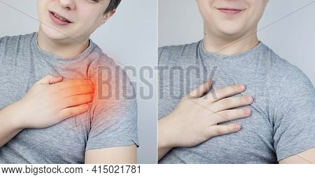 Before And After Shoulder Pain. Arthritis. Diseases Of The Joints. In The Photo On The Left, The Man